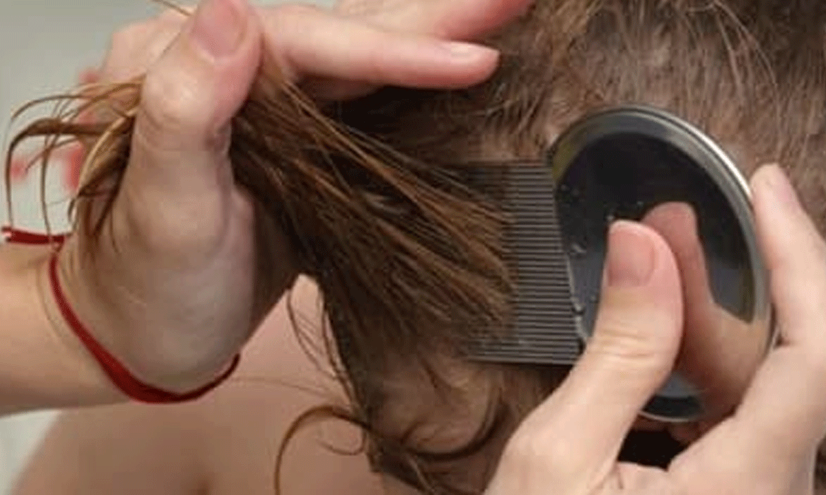 తలలో చిన్న పేనే కదా  అని అనుకుంటున్నారా... ఇదొకసారి చదవండి!