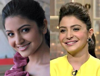 Dont worry about my lips: Anushka