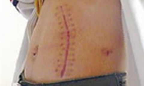 కిడ్నీ కావాలా.. ఇండియా వచ్చేయండి