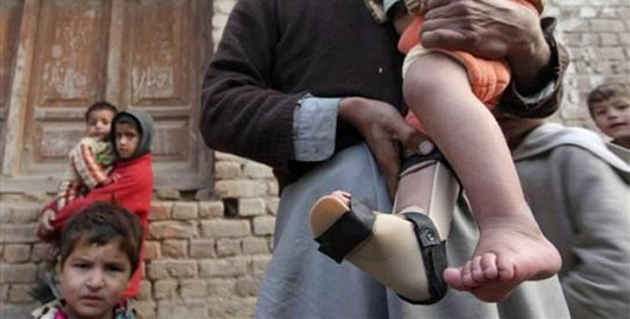 భారీ షాక్; హైదరాబాద్ లో పోలియో వైరస్