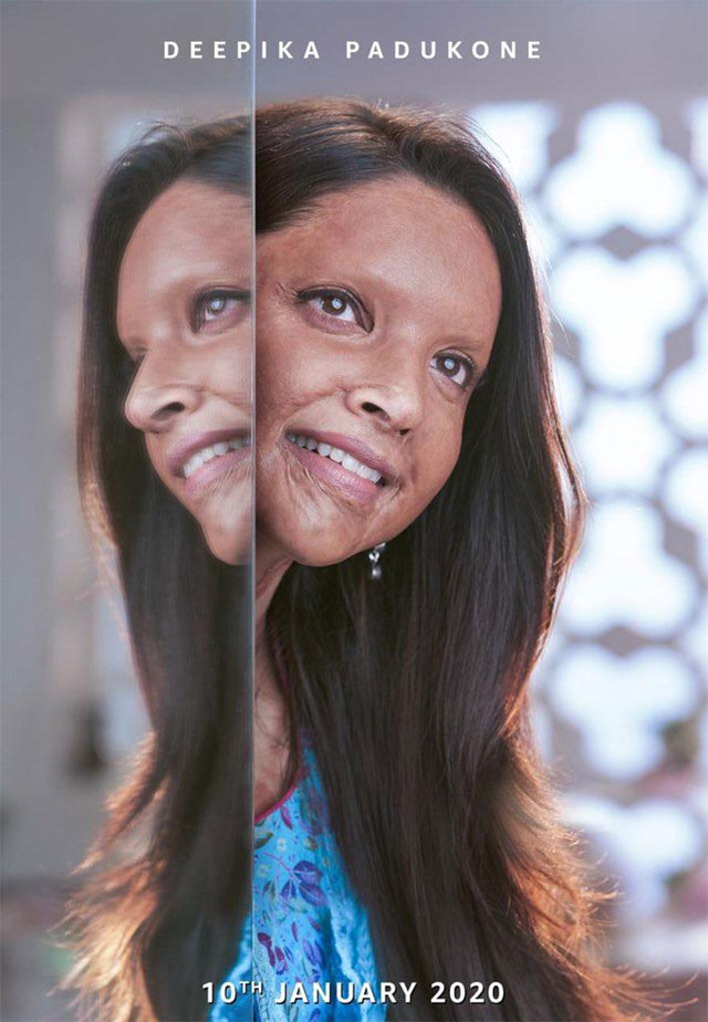 Deepikas Shocking First Look As Acid Attack Survivor Deepikas Shocking First Look As Acid Attack Survivor