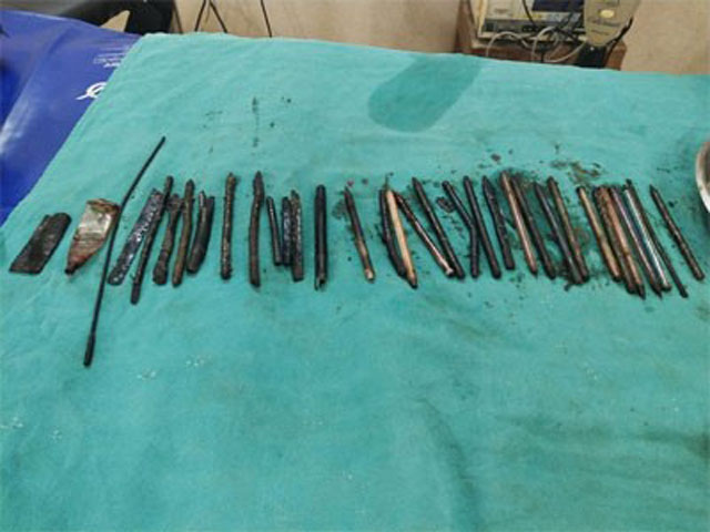 అత‌డి పొట్టా.. పాత సామాన్ల షాపా?