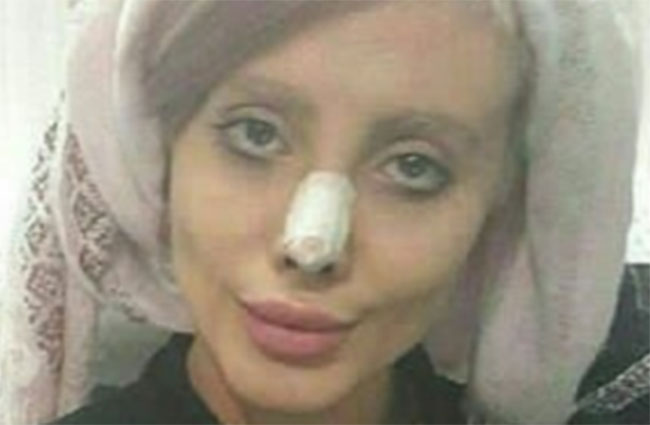 50 ప్లాస్టిక్ స‌ర్జ‌రీల న‌టికి క‌రోనా.. స‌ర్జ‌రీలే ముప్పు?