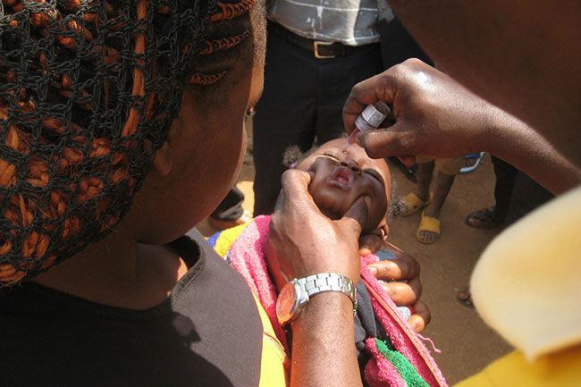 బాలుడిలో పోలియో లక్షణాలు.. భారత్​లో పోలియో అంతం కాలేదా?