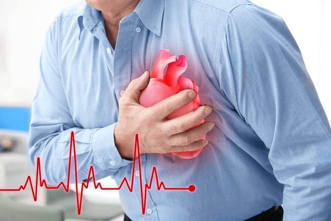 New Report: Deadliest Day For Heartattacks Found!